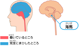 ܒiK@}