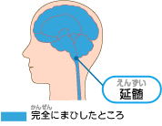 ZiK@}