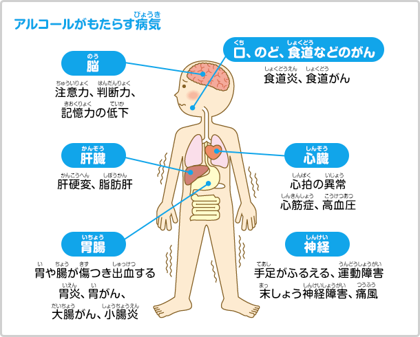 AR[炷aC